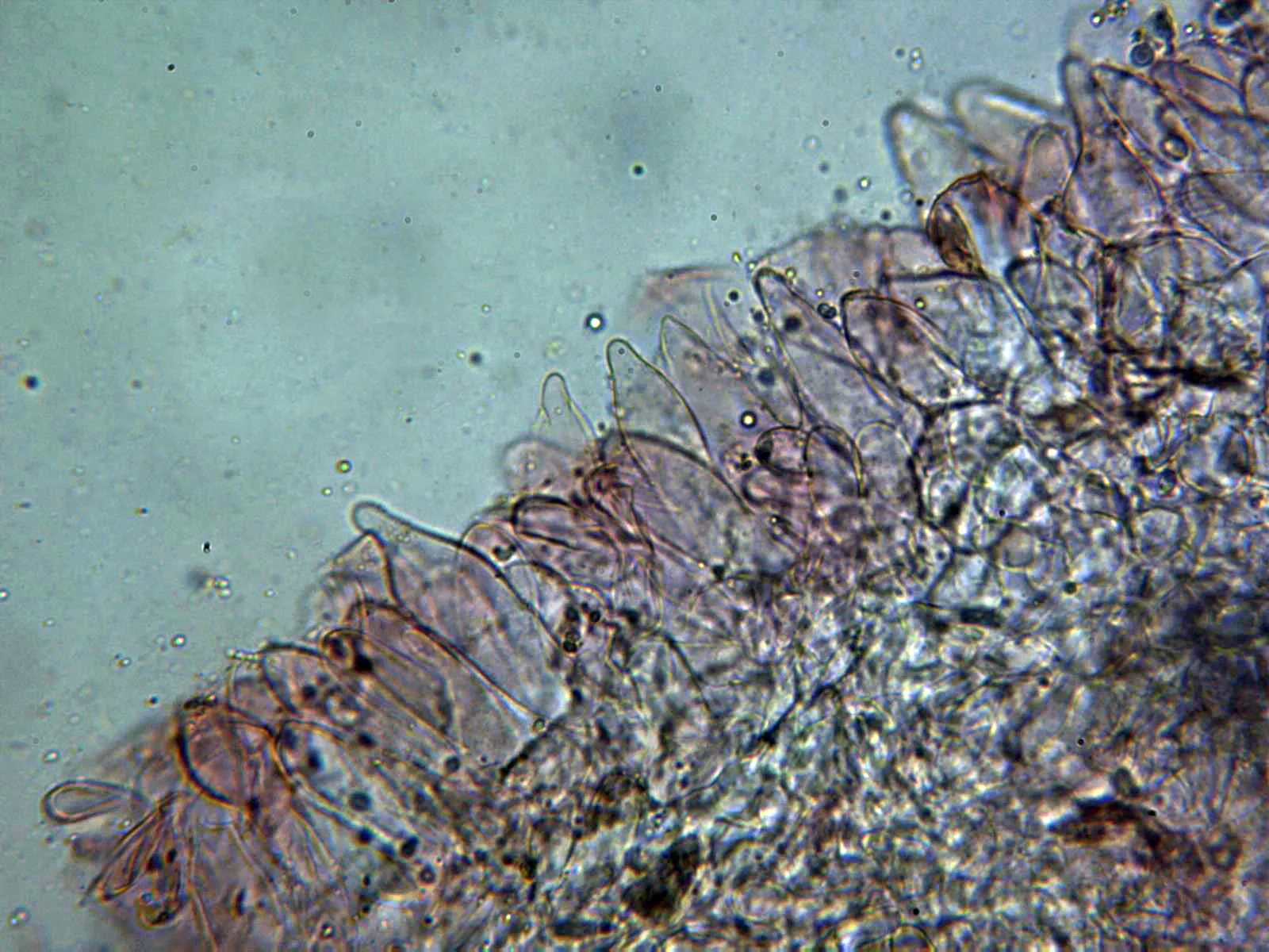 Microscopía de Pluteus thomsonii - 11 - Suprapellis x 400 2